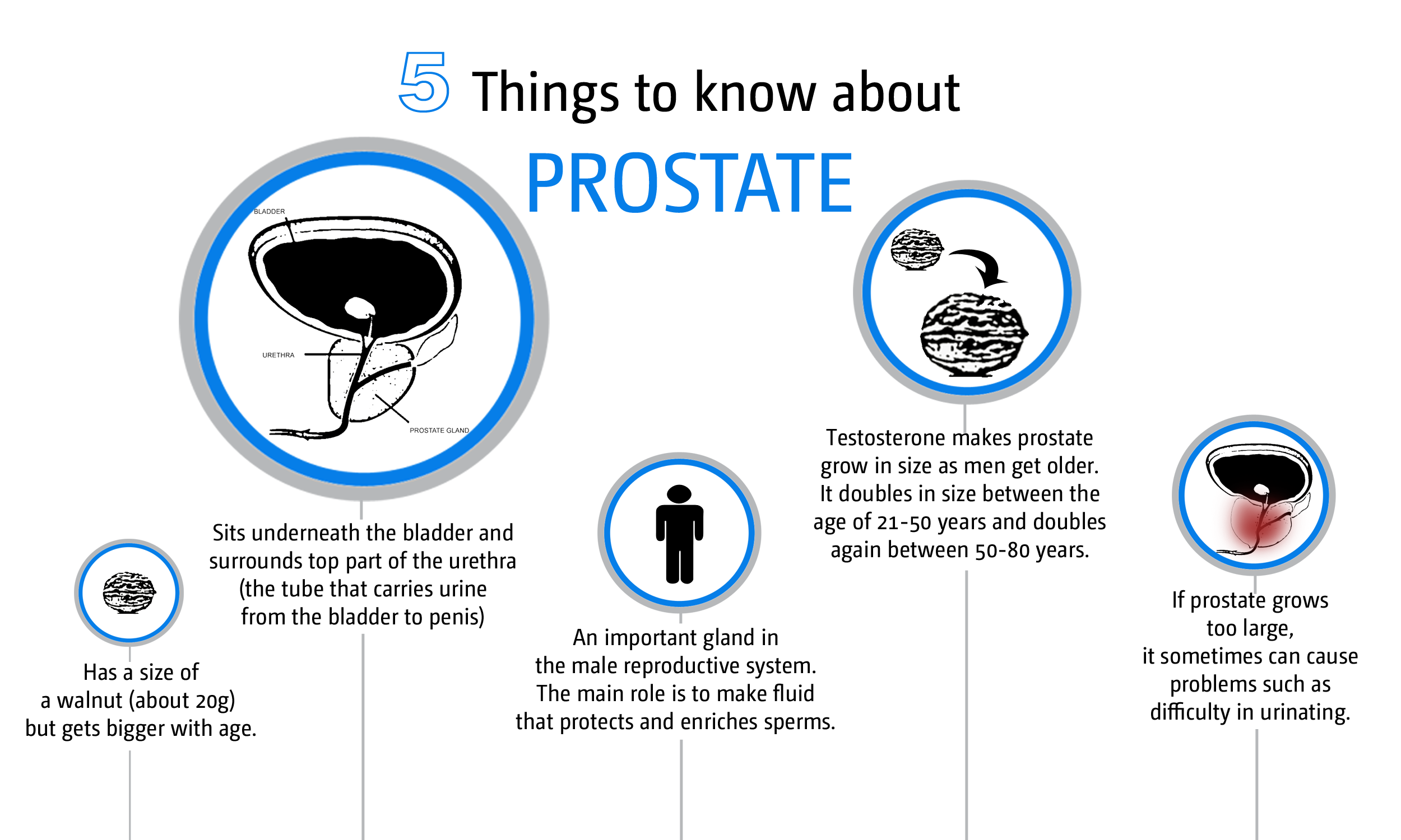 cdc-what-is-prostate-cancer